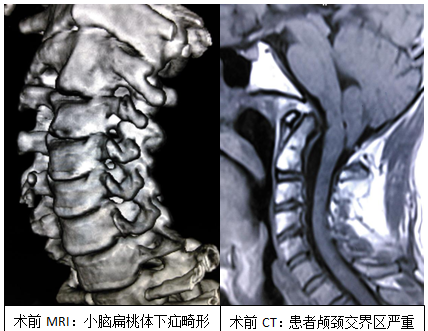 QQ图片20160930155055.png